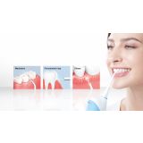 NEGA ZOB PANASONIC EW1211W845